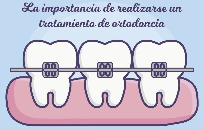 Travesí Ortodoncia: La importancia de realizarse un tratamiento de ortodoncia