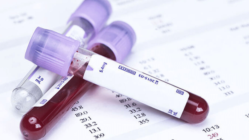 4 componentes que debes vigilar en tu sangre